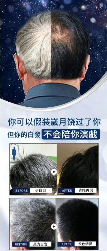 🖤 標題:白髮救星!苗染二代易染梳,梳一梳就變黑,告別美髮院! ✨ 📢 染髮不再求人!自己在家 15 分鐘搞定 還在忍受美髮院昂貴又耗時的染髮嗎?😫 還是受夠了傳統染髮劑調配得亂七八糟? 苗染全新二代升級版,把染髮膏跟梳子合二為一!輕輕一按、隨手一梳,白髮瞬間隱形,在家就能染出高級感! - 1