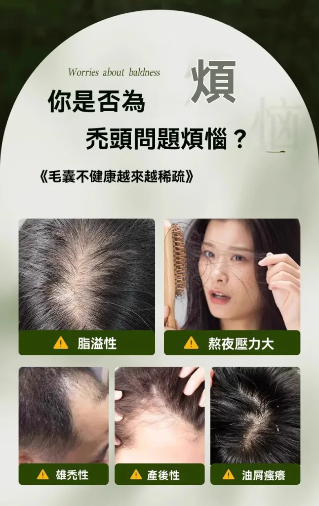 側柏葉洗髮皂、手工皂、洗頭皂、何首烏洗髮皂、烏斯曼草養發、固發控油去屑 - 16