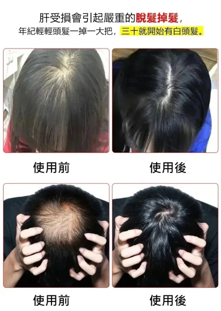 🔥【黃金顆粒·💓血管清道夫】 精選炒大麥茶－軟化血管輔助降三高，中老年人群健康守護之選 - 3